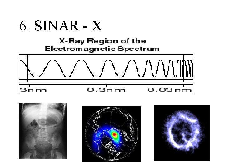 6. SINAR - X 