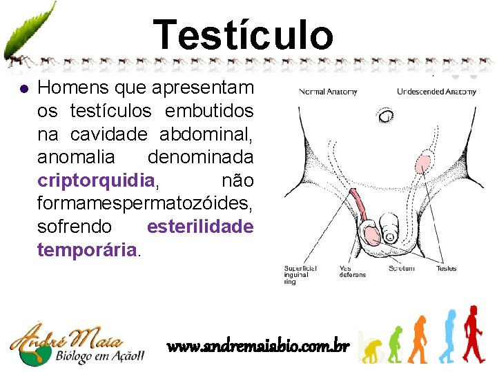 Testículo l Homens que apresentam os testículos embutidos na cavidade abdominal, anomalia denominada criptorquidia,