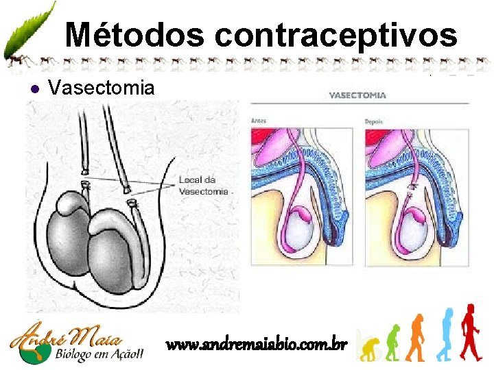 Métodos contraceptivos l Vasectomia www. andremaiabio. com. br 
