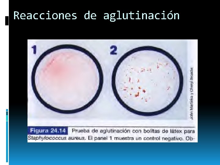 Reacciones de aglutinación 