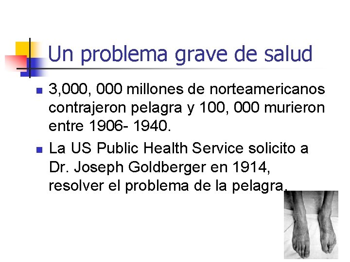 Un problema grave de salud n n 3, 000 millones de norteamericanos contrajeron pelagra