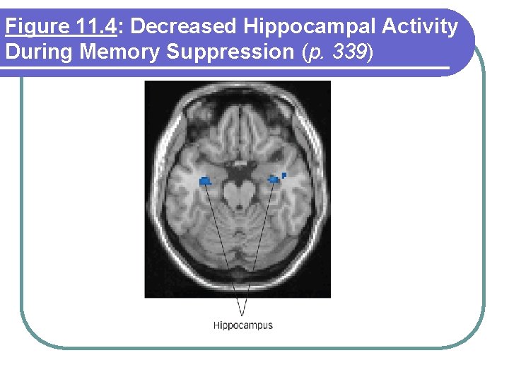 Figure 11. 4: Decreased Hippocampal Activity During Memory Suppression (p. 339) 