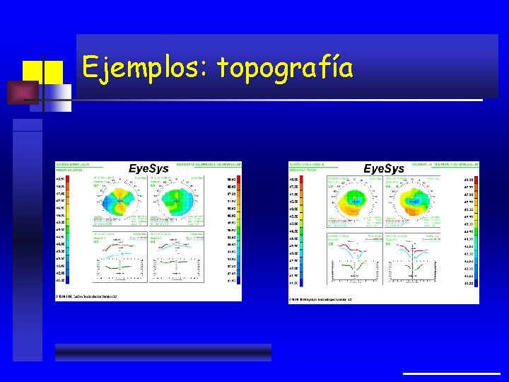 Ejemplos: topografía 