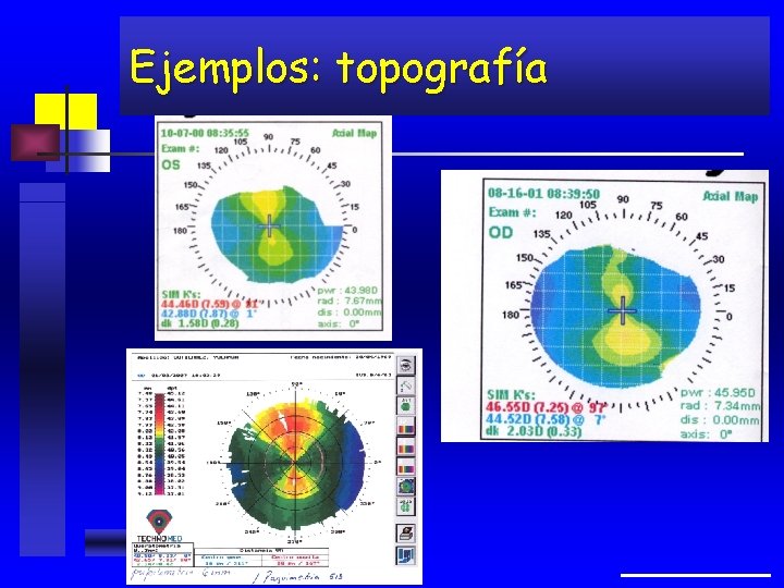 Ejemplos: topografía 