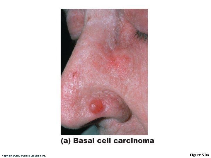 Copyright © 2010 Pearson Education, Inc. Figure 5. 8 a 