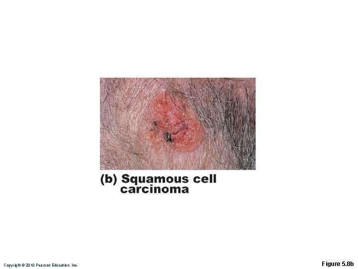 Copyright © 2010 Pearson Education, Inc. Figure 5. 8 b 