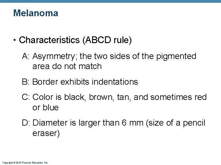 Melanoma • Characteristics (ABCD rule) A: Asymmetry; the two sides of the pigmented area Melanoma • Characteristics (ABCD rule) A: Asymmetry; the two sides of the pigmented area