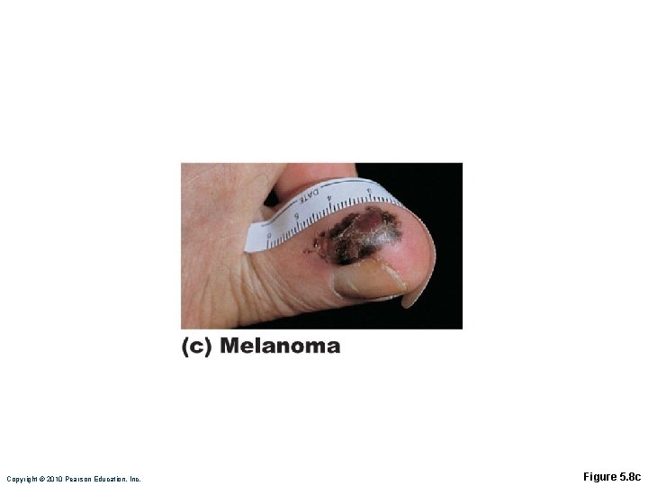 Copyright © 2010 Pearson Education, Inc. Figure 5. 8 c 