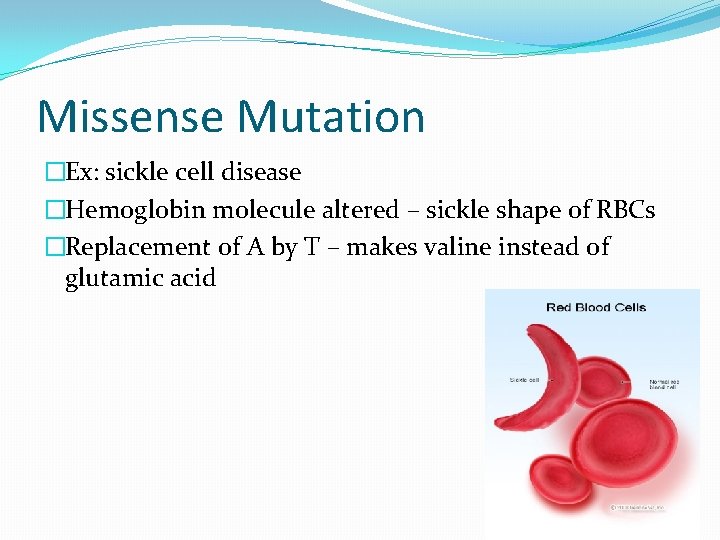 Missense Mutation �Ex: sickle cell disease �Hemoglobin molecule altered – sickle shape of RBCs