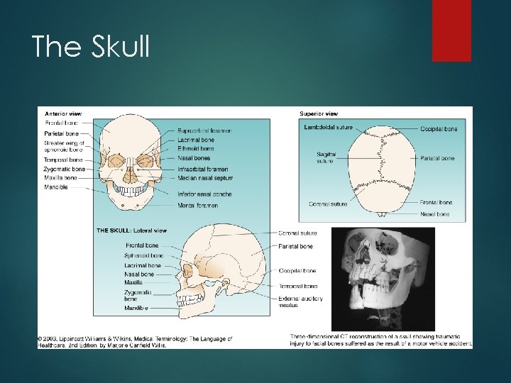 The Skull 