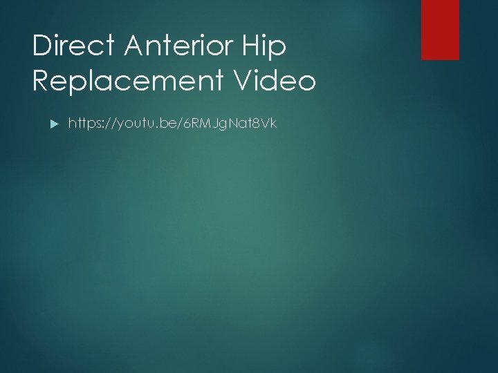 Direct Anterior Hip Replacement Video https: //youtu. be/6 RMJg. Nat 8 Vk 