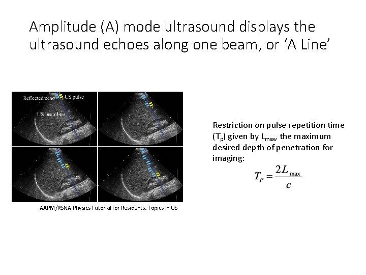 Amplitude (A) mode ultrasound displays the ultrasound echoes along one beam, or ‘A Line’