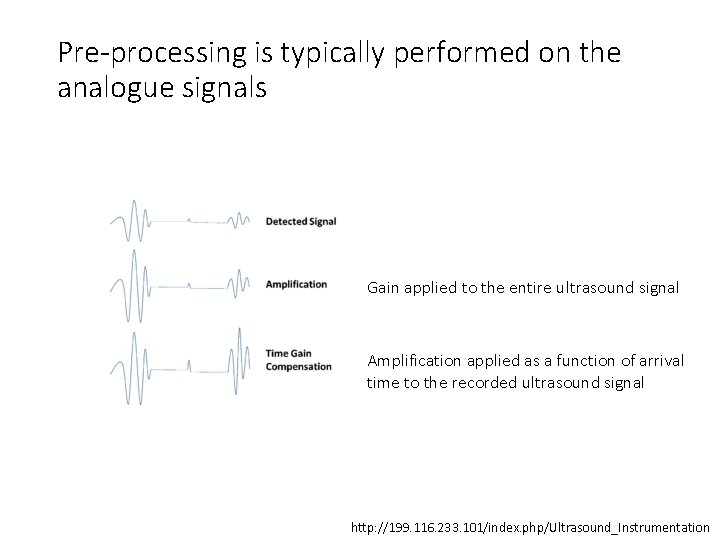 Pre-processing is typically performed on the analogue signals Gain applied to the entire ultrasound