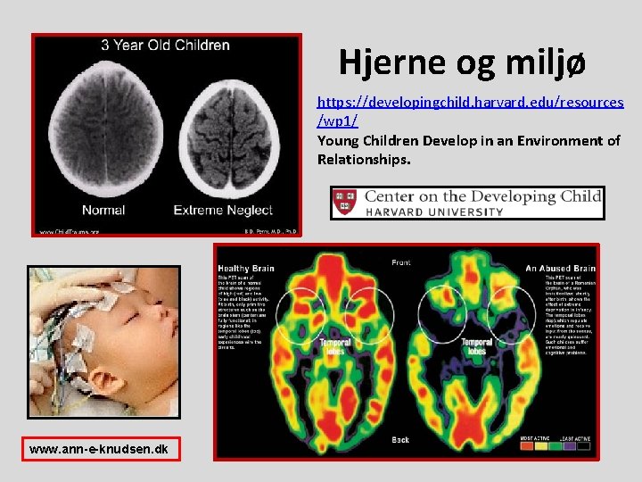 Hjerne og miljø https: //developingchild. harvard. edu/resources /wp 1/ Young Children Develop in an