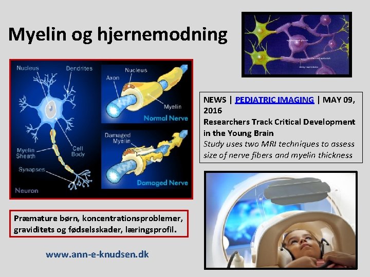 Myelin og hjernemodning NEWS | PEDIATRIC IMAGING | MAY 09, 2016 Researchers Track Critical