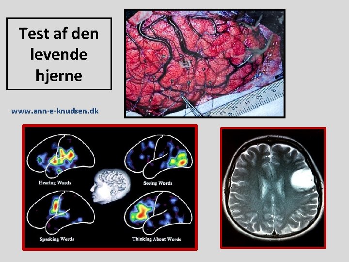 Test af den levende hjerne www. ann-e-knudsen. dk 