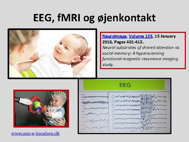 EEG, f. MRI og øjenkontakt Neuro. Image, Volume 125, 15 January 2016, Pages 401