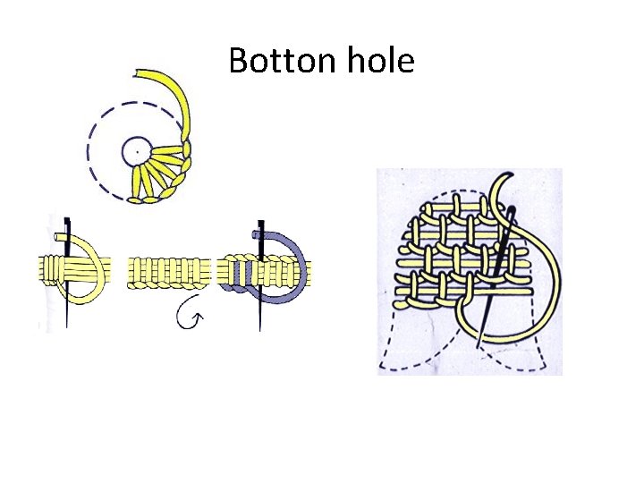 Botton hole 