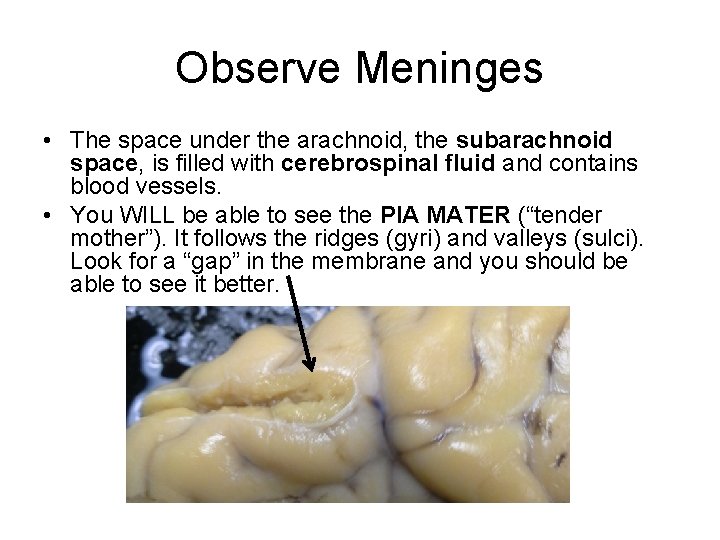 Observe Meninges • The space under the arachnoid, the subarachnoid space, is filled with