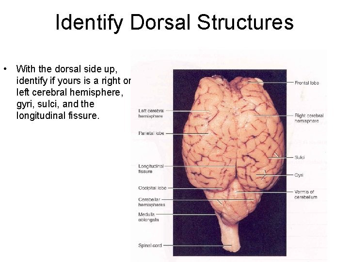 Identify Dorsal Structures • With the dorsal side up, identify if yours is a