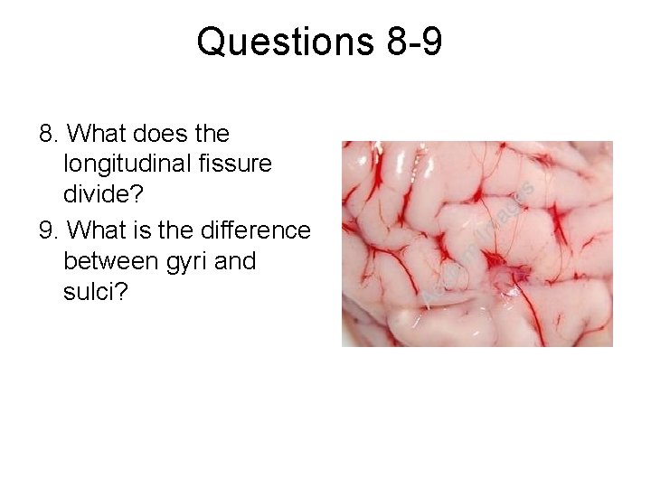 Questions 8 -9 8. What does the longitudinal fissure divide? 9. What is the Questions 8 -9 8. What does the longitudinal fissure divide? 9. What is the