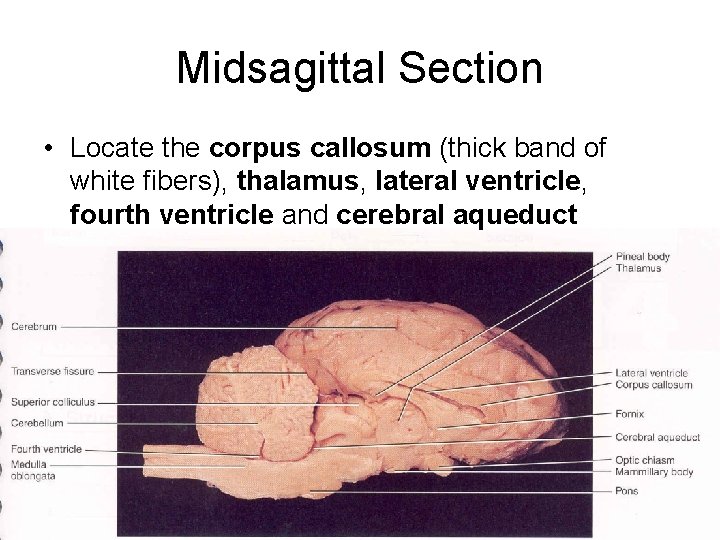 Midsagittal Section • Locate the corpus callosum (thick band of white fibers), thalamus, lateral Midsagittal Section • Locate the corpus callosum (thick band of white fibers), thalamus, lateral