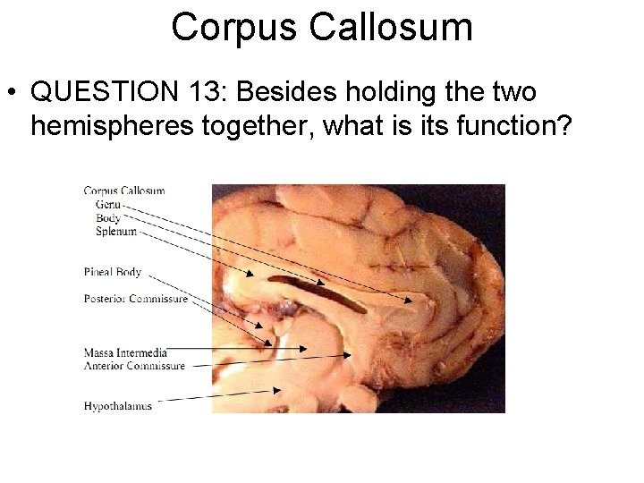 Corpus Callosum • QUESTION 13: Besides holding the two hemispheres together, what is its