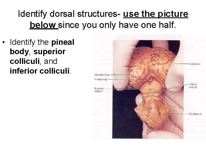 Identify dorsal structures- use the picture below since you only have one half. •