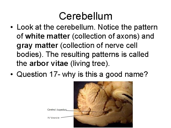 Cerebellum • Look at the cerebellum. Notice the pattern of white matter (collection of Cerebellum • Look at the cerebellum. Notice the pattern of white matter (collection of