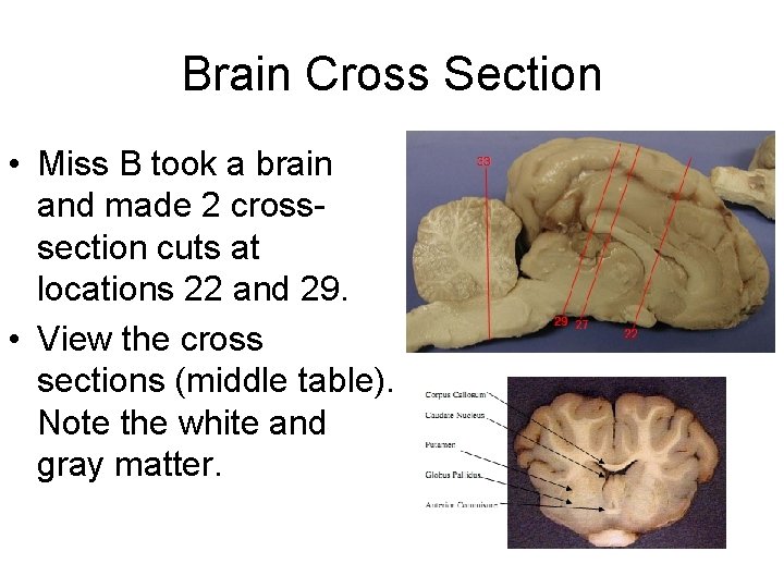 Brain Cross Section • Miss B took a brain and made 2 crosssection cuts Brain Cross Section • Miss B took a brain and made 2 crosssection cuts