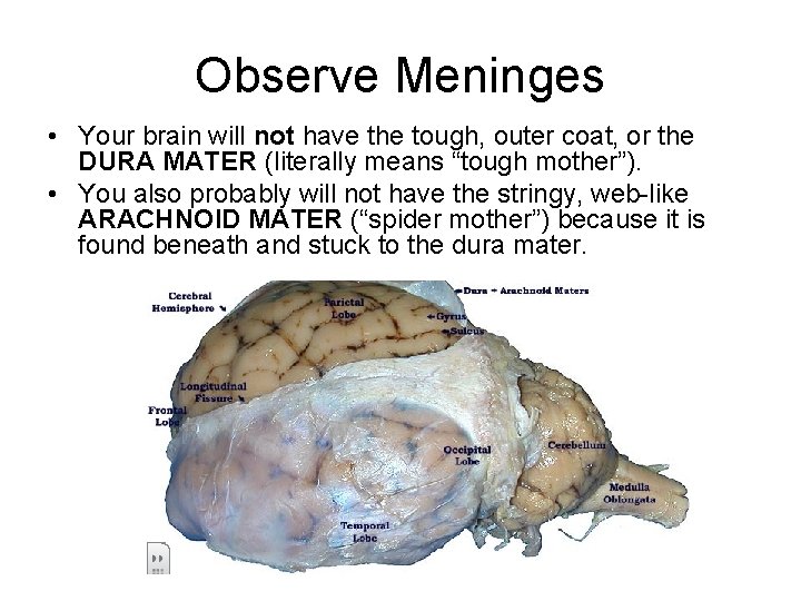 Observe Meninges • Your brain will not have the tough, outer coat, or the