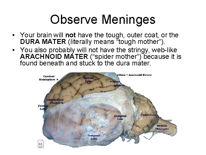 Observe Meninges • Your brain will not have the tough, outer coat, or the Observe Meninges • Your brain will not have the tough, outer coat, or the