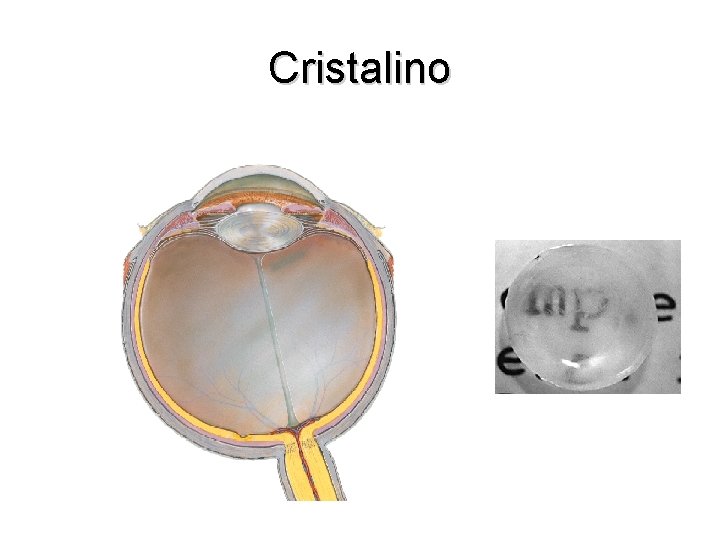 Cristalino 