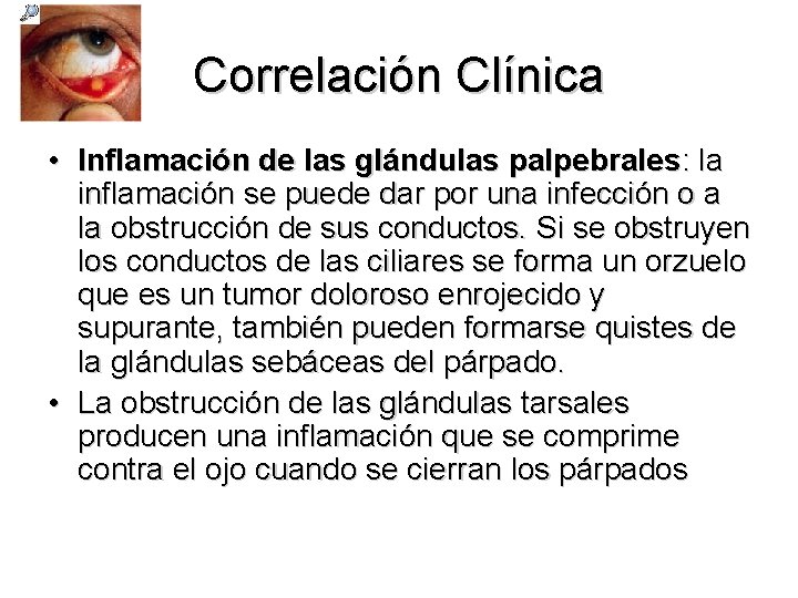 Correlación Clínica • Inflamación de las glándulas palpebrales: la inflamación se puede dar por