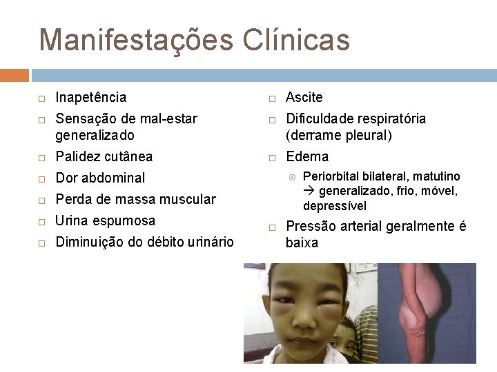 Manifestações Clínicas Inapetência Sensação de mal estar generalizado Palidez cutânea Dor abdominal Perda de