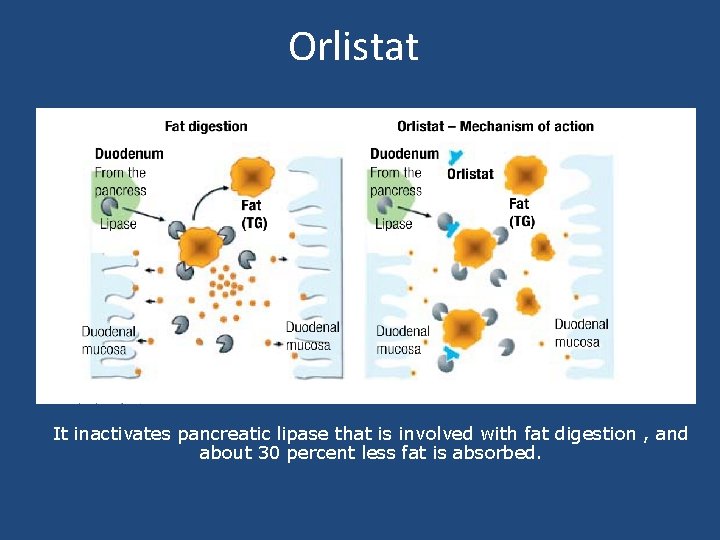 Orlistat It inactivates pancreatic lipase that is involved with fat digestion , and about