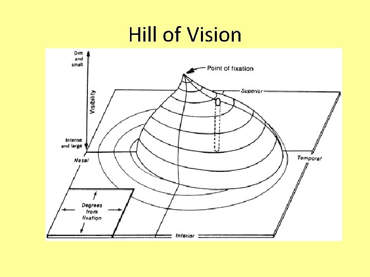 Hill of Vision 