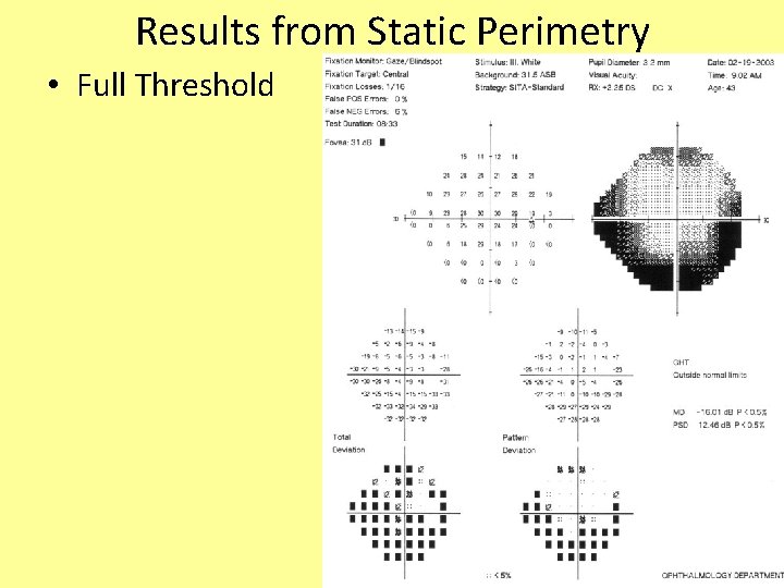 Results from Static Perimetry • Full Threshold 