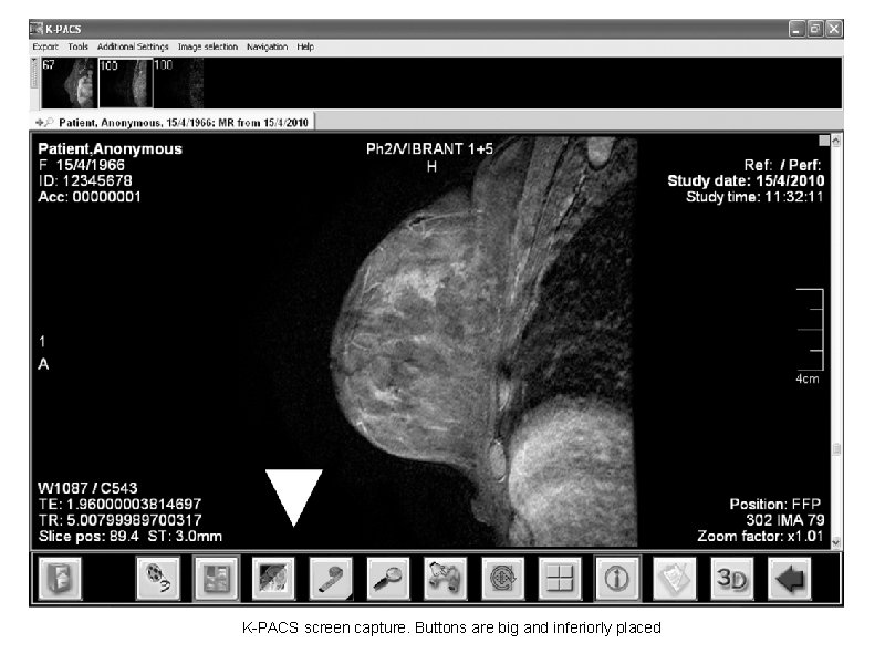 K-PACS screen capture. Buttons are big and inferiorly placed 