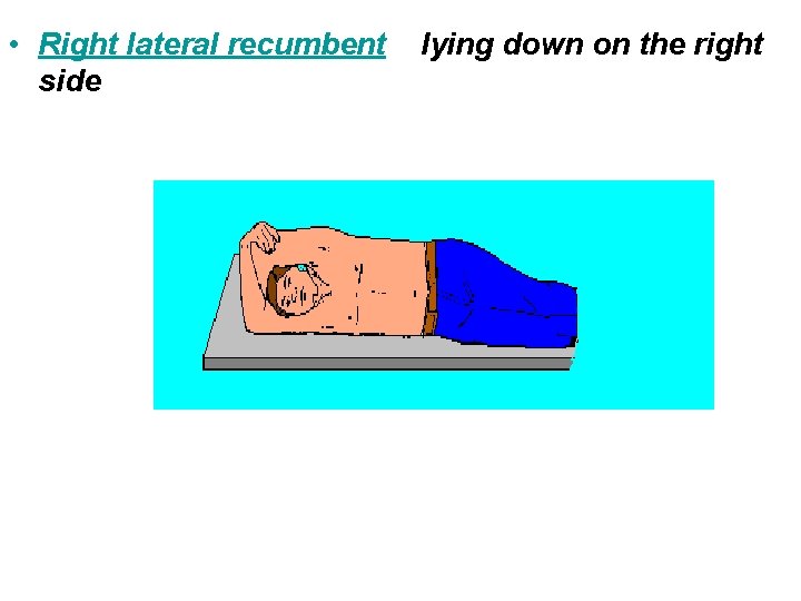 • Right lateral recumbent side lying down on the right • Right lateral recumbent side lying down on the right