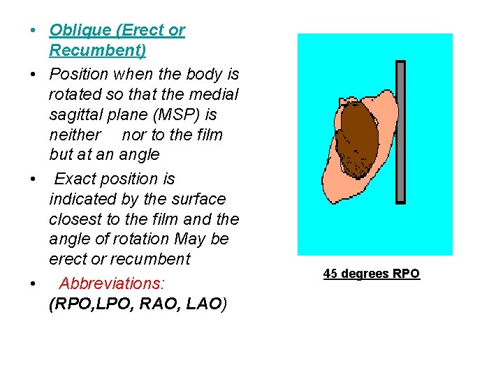 • Oblique (Erect or Recumbent) • Position when the body is rotated so • Oblique (Erect or Recumbent) • Position when the body is rotated so