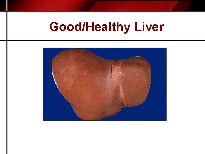 Good/Healthy Liver 
