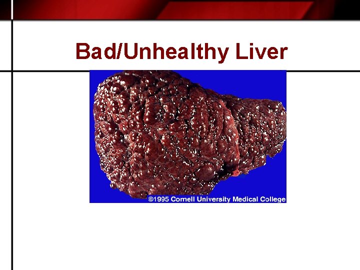 Bad/Unhealthy Liver 
