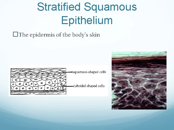 Stratified Squamous Epithelium �The epidermis of the body’s skin 