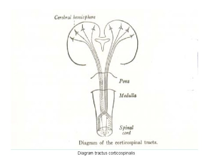 Diagram tractus corticospinalis 
