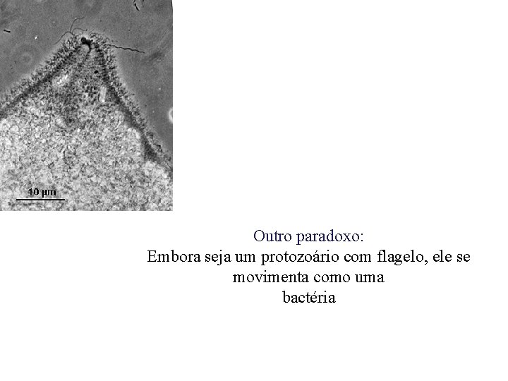 Outro paradoxo: Embora seja um protozoário com flagelo, ele se movimenta como uma bactéria