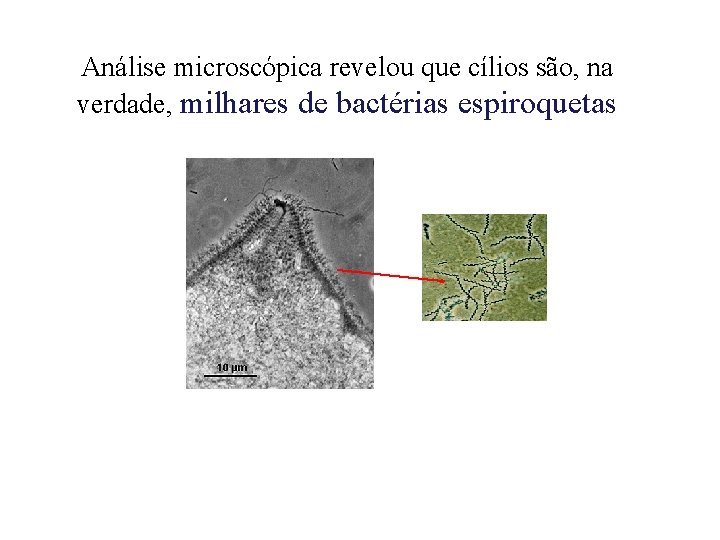 Análise microscópica revelou que cílios são, na verdade, milhares de bactérias espiroquetas 