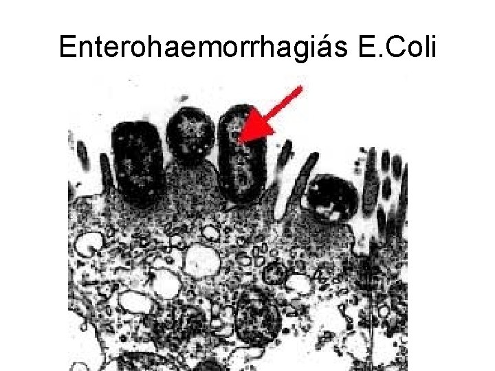 Enterohaemorrhagiás E. Coli 