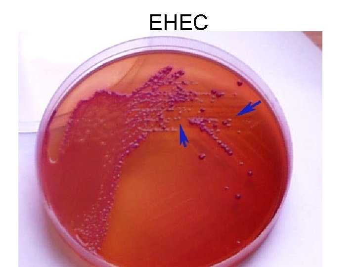 EHEC 