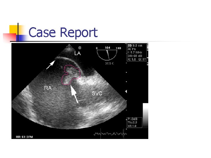 Case Report 